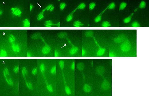 R(3) embryonic mitoses from time-lapse video, showing a) linked sister chromatids that stretch and then resolve into separate and intact daughter rings; b) linked sister chromatids that do not resolve followed by daughter nuclei moving back together; and c) a dicentric double bridge, likely formed by SCE or SCU. The arrows in a) and b) indicate regions of concentrated chromatin at the junctions of sister chromatids.