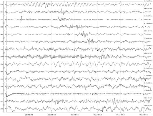 WEBNET seismograms of the local event (2008 November 14) undetected by SLRNN with the six-station coincidence. Manually estimated magnitude ML = −0.5. Only vertical components of the ground-motion velocity (BP 1–40 Hz applied) are displayed. Stations are sorted by epicentral distance (top trace corresponds to the nearest station).