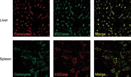 Cellular localization in tissues. Four groups of animals were injected with different combinations of fluorescently labeled Cerezyme® and kGCase as described in Materials and methods section. Group 1 received a combination of unlabeled Cerezyme® and kGCase, Group 2 received a combination of AF546-labeled Cerezyme® and OG488-labeled kGCase; Group 3 received a combination of OG488-labeled Cerezyme® and AF546-labeled kGCase, and animals in Group 4 received a combination of OG488-labeled Cerezyme® and AF546-labeled Cerezyme®. Each group consisted of three animals. Shown above are confocal images of the fluorescence of representative tissue slices from a Group 2 animal (liver) and a Group 3 animal (spleen).