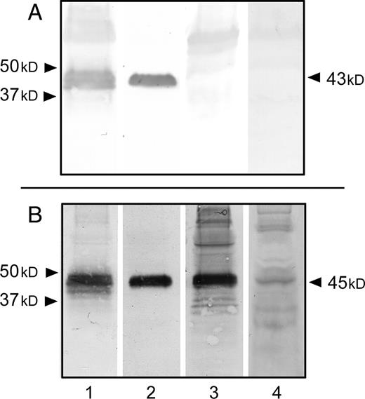 Immunodetection of the αGal epitope and J28 glycotope in extracellular media of control cells and transfected cells. Total (glyco)proteins (100 µg/lane) of concentrated and desalted cell culture media of control cells (A) and transfected cells (B) were separated by SDS–PAGE and electrotransferred onto a nitrocellulose membrane. The membranes were then probed with pAbL64 (lane 1), mAbJ28 (lane 2), biotin-labeled IB4 lectin (lane 3) and human natural anti-αGal antibodies (lane 4). Arrowheads (left) indicate the position of calibrated molecular mass standard proteins and arrows (right) indicate the apparent molecular size of recombinant O-glycosylated C-terminal glycopeptides of FAPP produced by cell clones and detected in extracellular media.