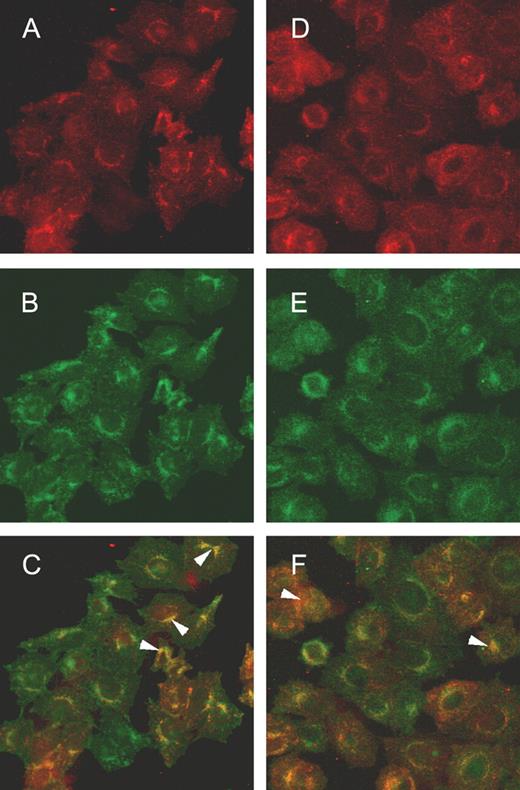 Colocalization of the αGal epitope and J28 glycotope in transfected cells by confocal microscopy. Transfected cells were incubated with mAbJ28 followed by anti-mouse-Alexa 594 antibodies (A) and FITC-labeled IB4 (B). Panel C shows the merged images. The cells were also incubated with mAbJ28 followed by anti-mouse-Alexa 594 (D) and human natural anti-αGal antibodies followed with anti-human-Alexa 488 antibodies (E). Panel F shows the merged images. The yellow color represents the coincidence of red and green pixels, indicating the colocalization of the J28 glycotope and the αGal epitope. The arrowheads in C and F indicate some specific areas of the J28 glycotope and the αGal epitope colocalization. The magnification is ×40.