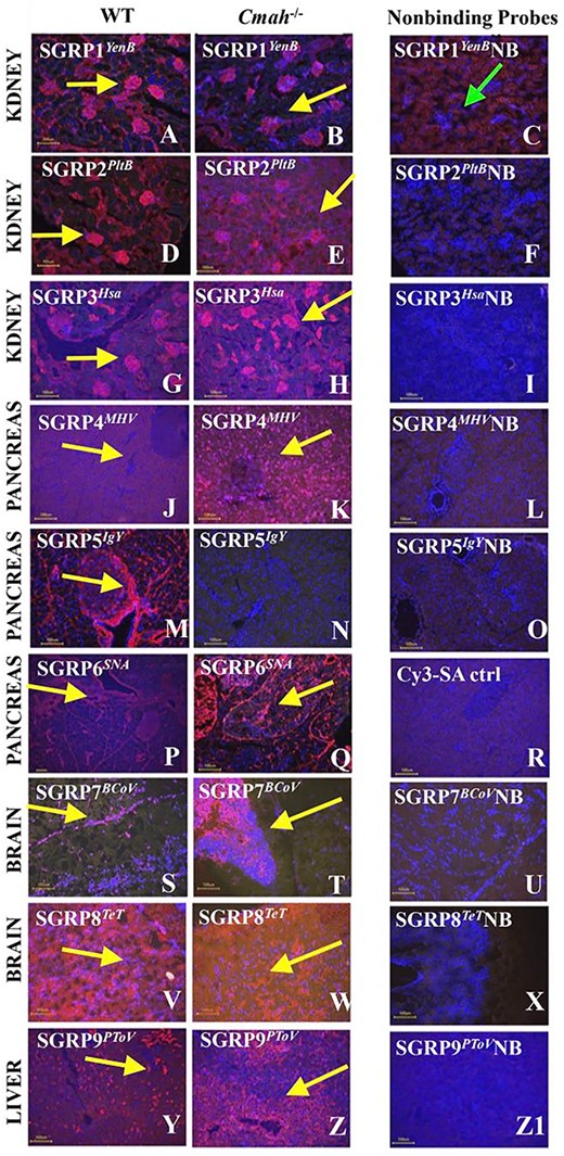 Histological analysis of frozen mouse tissues by SGRPs. Examples of binding patterns (red-Cy3 streptavidin) observed with each SGRP probe (on different organs of the wild-type and the cmah null mouse strain). Panels a, b, d, e, g, and h show the detection of kidney glomeruli, (yellow arrows) by SGRP1YenB and SGRP2PltB (each used at 5 μg/ml) and SGRP3Hsa, used at 3 μg/ml. In contrast, the nonbinding probe does not bind to glomeruli, as shown in panels c, f, and i. Pancreas exocrine mucin producing glands and intervening fibrous stroma are recognized by SGRP4MHV (used at 5 μg/ml), SGRP5IgY (used at 1 μg/ml) and SGRP6SNA (used at 2 μg/ml) indicated by arrows in panels g, h, j, k, and m. However, with SGRP5IgY as expected, there is no binding to Cmah null tissues; (panel n), the nonbinding controls also do not bind, as shown in panels l and o. Panel r represents secondary only control for SNA, with no binding. Brain meninges and white matter are recognized by SGRP7BCov (used at 10 μg/ml) and SGRP8TeT (used at 5 μg/ml), demonstrated with arrows on panels s, t, v, and w. The nonbinding controls do not bind shown in panels u and x. Liver macrophages are recognized in the wild-type animal by SGRPPToV, and interestingly, in the Cmah null animal, SGRPPToV binds to hepatocyte membranes closest to the central vein, indicating a different pathology in this genetically altered animal strain. The nonbinding control shows no binding (panel ZI). Nuclei are designated blue color by Hoechst stain.