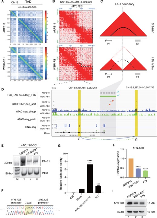 TAD separation hinders the formation of an intrachromosomal loop in the MYL12B locus