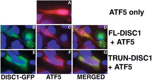 Figure 8. DISC1 interactions with ATF4 and ATF5. (A–G) FL-DISC1 or TRUN-DISC1 co-localizations with ATF5 in SH-SY5Y human neuroblastoma cells transiently transfected with DISC1-GFP and ATF5-Xpress. DISC1 protein is visualized in green, ATF5 in red, nuclei in blue. (H) ATF4 and ATF5 constructs used in luciferase assay, and summary of luciferase assay results with each construct. (I) ATF4 Luciferase assay results. (J) ATF5 Luciferase assay results. (K) ATF5 deletion expression constructs used in co-immunoprecipitation assays and a summary of their binding to DISC1 deletion constructs diagrammed in Figure 6A. (L) Results of coimmunoprecipitations in HEK293 cells.