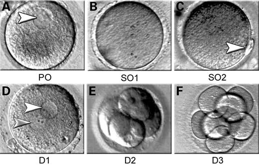 Figure 1. Morphological features of human development at the oocyte to embryo transition. ( A ) Primary oocyte (PO) with an intact germinal vesicle (arrow); ( B ) secondary oocyte in metaphase I (SO1) distinguished by the absence of the germinal vesicle; ( C ) fertilization-competent secondary oocyte in metaphase II (SO2) with an extruded first polar body (arrow); ( D ) one-cell embryo on day 1 (D1) as evidenced by the appearance of two pronuclei (arrows), containing a haploid male or female set of chromosomes; ( E ) embryo containing four cells on day 2 (D2); and ( F ) eight-cell embryo on day 3 (D3).