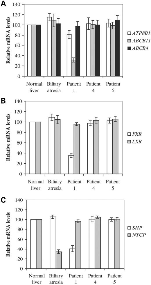 Figure 3. Relative expression of specific genes in liver from patients with cholestasis. Poly(A)+ RNA was isolated from the indicated liver samples and subjected to quantitative real-time PCR. Assays were performed in duplicate and normalized to β2-microglobulin. Expression of ABC transporters is shown in (A) nuclear receptors in (B) and SHP and NTCP in (C). Data represent the mean ±SEM of three experiments performed with three separate cDNA preparations from each sample. Values in normal liver were arbitrarily set to 100.