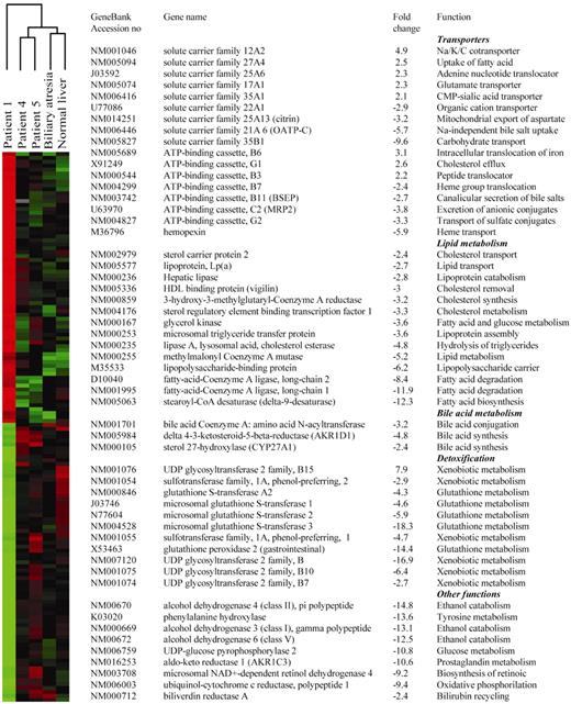 Figure 5. Gene array studies. The pattern of expression of 8327 genes were compared in the indicated samples. (Left panel) Hierarchical clustering of 163 human transcripts with differential expression in patient 1. The expression data from each patient are represented by a colour gradient from red (relatively high expression) to green (relatively low expression). Black denotes no change. (Right panel) List of representative genes differentially expressed in patient 1. Fold changes represent the average change over the other four samples.