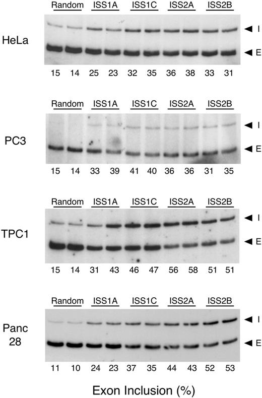 Figure 5. Effect of ISS antisense MO treatment in other human cell lines. RT–PCR analysis of endogenous FGFR1 α-exon splicing was performed on cervical carcinoma (HeLa), prostate carcinoma (PC3), thyroid carcinoma (TPC-1), and pancreatic adenocarcinoma (Panc 28) cells, after treatment with the 2 µM MOs. I, α-exon inclusion; E, α-exon exclusion.