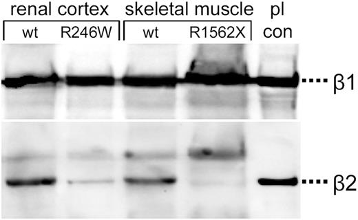 Figure 6. Western blotting of proteins from renal cortex of an affected infant with the mutation R246W and from skeletal muscle of an affected fetus carrying the mutation R1562X compared with tissues of age-matched controls (wt). Placental laminins (pl con) served as a positive control. Consecutive staining of the blot for laminin β2 (bottom) and laminin β1 (top) showing complete lack of laminin β2 immunoreactivity in the mutant R1562X and severe reduction in the mutant R246W.