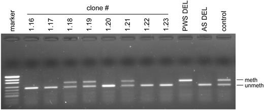 Figure 3. MS-PCR analysis of cloned fibroblasts from patient ASID-71. Clones 1.16, 1.17, 1.20, 1.22 and 1.23 show an AS pattern (lack of methylated band), whereas clones 1.18, 1.19 and 1.21 show a normal pattern. Abbreviations as in Figure 1.