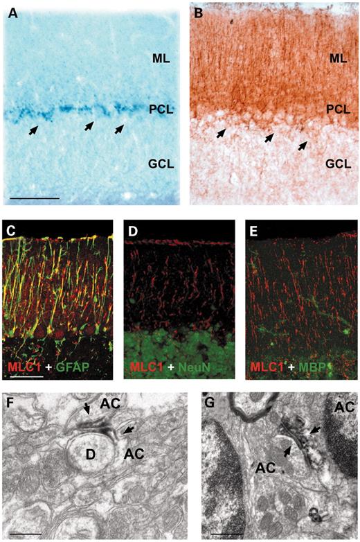 Figure 3. ISH and immunohistochemistry of MLC1 in the cerebellum cortex. Cerebellar sections were processed using ISH (A) or immunocytochemistry (B) using peroxidase-coupled secondary antibodies. The mRNA signal was enriched in the Purkinje cell layer (PCL), but it also protruded into the molecular layer (ML). Arrows indicate Purkinje neurons. (C–E) Confocal images of adult brain mice sections stained with MLC1 (red), GFAP (green, C), a typical astocytic marker, NeuN (green, D), a nuclear neuronal marker, and MBP (green E), an oligodendrocyte marker. No colocalization was detected between NeuN and MBP, indicating that MLC1 is not present in neurons or in oligodendrocytes in the cerebellum cortex. A clear colocalization with GFAP is seen, indicating that MLC1 is present in Bergmann glia. Overlapping expression is shown in yellow. (F, G) Electron micrographs showing the localization of MLC1 in the cerebellum. Arrows indicates peroxidase staining. AC, astrocyte; D, dendrite. These pictures show that MLC1 is located in astrocyte–astrocyte membrane contacts, and sometimes in closer contacts to neuronal processes (F). Bars (A, B) 80 µm; (C, D, E) 50 µm; (F) 0.28 µm; (G) 0.5 µm.