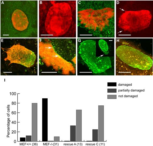 Figure 4. Nuclear damage during compression, visualized with Cell Tracker Green combined with PI (A–D) or with Cell Tracker Orange combined with PI (E–H). In all samples, the prominent fluorescent signal in the central region of the cell results from PI fluorescence. Note that especially Cell Tracker Orange forms cytoplasmic aggregates in these cells. (A and B) Absence of visual nuclear damage in two MEF+/+ cells after compression. The nuclear shape of these nuclei remains intact, with chromatin still located in a sharply delineated nuclear compartment. (C and D) Damaged nuclei of MEF−/− cells that did burst during compression, with chromatin protruding into the cytoplasm as large (C) or small irregular lobules (arrows in D). (E–H) Depending on the amount of transfected lamins at the nuclear membrane, rescued nuclei transfected with lamin A(–EGFP) showed no disruption, or partial disruption at areas with so-called honeycomb lamin patterns (E), and less disruption in areas with high levels of lamin A (F, arrow). Similar observations were made for lamin C(–EGFP) rescued cells with preservation of nuclear shape in cells, with high levels of lamin C (H) and disruption of areas lacking lamin C (G, arrow). Inset in (G) shows lamin C fluorescence before compression and the predicted weak spot in the nucleus, which indeed did burst during compression (Supplementary Material, Movie S3). (I) Quantitative comparison of visual nuclear damage between MEF+/+ and MEF−/− cells and A-type lamin-rescued cells. The number of analysed cells for each category is shown in parentheses. Undamaged nuclei: all DNA remains in nucleus after compression. Partial damage: one or more areas of the nucleus show protrusions of DNA into the cytoplasm, whereas the remaining nucleus remains intact. Damage: DNA protrudes into the cytoplasm into all directions. Note that nuclear damage as seen in MEF−/− is largely prevented after rescue with either lamin A or lamin C. Bar represents 10 µm in all figures.