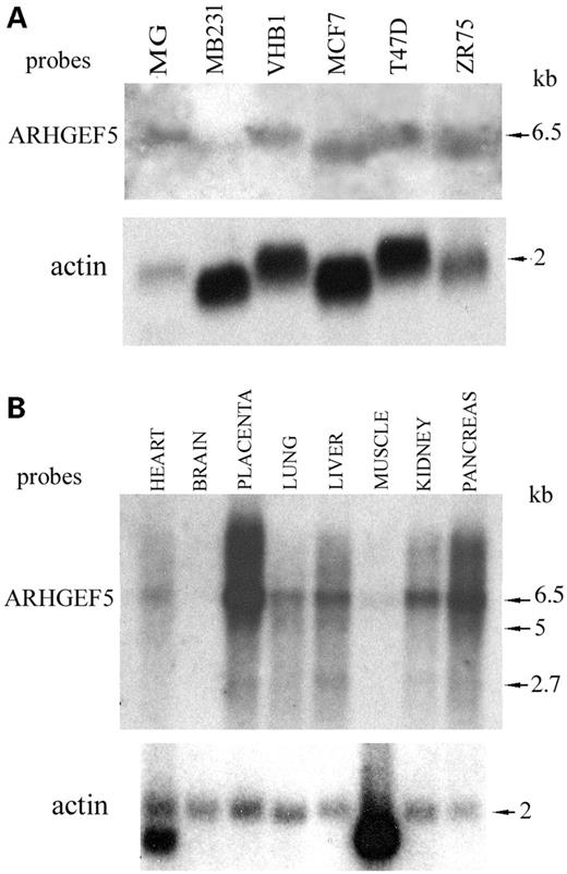 Figure 2. Northern blot analysis of ARHGEF5/TIM transcripts in breast carcinoma cells and healthy tissues. (A) Total RNAs extracted from healthy mammary gland (MG, 15 µg) and breast carcinoma cell lines (50 µg) were electrophoresed and transferred to a nylon membrane. (B) Multitissue northern (Clontech) with mRNAs from various healthy tissues. The filters were probed with a 600 bp ARHGEF5/TIM cDNA probe amplified with primers 2F/2R (A, B upper panels) and with a β-actin probe (A, B lower panels). The size of the transcripts is indicated.