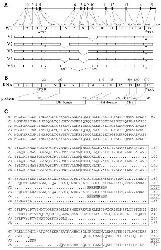 Figure 4. Structure of the ARHGEF5/TIM variant transcripts and sequences of the predicted variant proteins. Amplified products depicted in Figure 3 were cloned and sequenced. (A) Schematic representation of the variant transcripts V1 to V5. (B) Schematic representation of the protein encoded by the WT transcript. (C) Sequence alignment of the N-terminal region and DH domain of WT and predicted variant proteins. The length of V2, V3 and V4 truncated proteins is indicated by boxed numbers followed by a star. Boxed area denotes the ARHGEF5/TIM DH domain. Mutations are shaded.