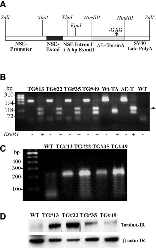 Figure 1. DYT1 transgenic mice analysis. ( A ) Scheme of full-length DNA construct used for the generation of transgenic mouse, showing regions of NSE promoter with exon I, intron I and 6 bp from exon II. The arrow indicates GAG deletion in torsinA cDNA. A SV40 polyadenylation signal sequence is added at the 3′ end of torsinA. ( B ) Genotyping of transgenic mice was done by performing PCR on DNA isolated from tail biopsy of mice followed by digestion of the PCR product with Bse RI restriction enzyme. Cloned cDNAs for wild-type torsinA (Wt-TA) and ΔE-torsinA (ΔE-TA) served as positive controls. PCR amplification of tail and cloned wild-type torsinA and ΔE-torsinA cDNAs yielded a 213 bp DNA product. Digestion of PCR amplified product from the wild-type torsinA cDNA yielded DNA fragments of 24 bp (not seen in figure), 94 and 95 bp fragments (which co-migrate on the agarose gel). In contrast, the mutant cDNA yielded DNA fragments of 95 and 118 bp (arrow) due to the loss of a Bse RI restriction site. − and + indicates the absence or presence of Bse RI restriction enzyme. ( C ) RT–PCR was performed to show the expression of transgene transcript in the brains of transgenic mice. The panel shows that the mRNA for ΔE-torsinA is expressed in all the transgenic lines. ( D ) Western blot analysis of brain homogenates obtained from wild-type control and independent transgenic mouse lines. β-Actin immunoreactivity was used to ensure equal amounts of protein loaded. WT, wild-type control mouse; TG, transgenic mouse; # indicates the line number of mouse. Arrow indicates the additional DNA band seen in transgenic. 