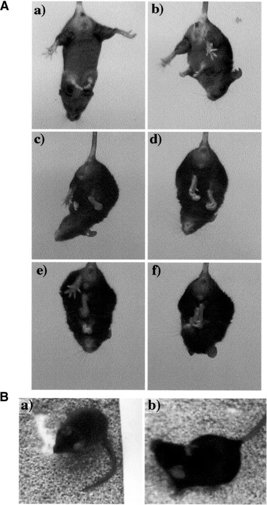 Figure 2. Transgenic mice exhibit self-clasping of limbs and head shaking. Transgenic mice exhibited self-clasping of limbs and abnormal head movements and posturing that were video taped. ( A ) Transgenic mouse showing various self-clasping movements of limbs [(c)–(f)] and the wild-type control mouse is shown in (a) and (b). (TG#13, n =42/66; TG#22, n =5/14 TG#35, n =5/14 and TG#49, n =6/12). Mice aged 6–7 weeks were used for the study. ( B ) Wild-type control with normal head posture (a) and transgenic mouse with abnormal head posture (b). 