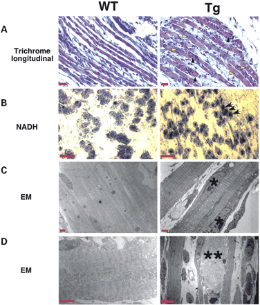 Figure 2. MCKCUG-BP1 mice display abnormal histology, histochemistry and EM, with features resembling the muscle pathology of DM. (A) Gomori trichrome of longitudinal sections of skeletal muscle. The chains of internal nuclei are more prominent in MCKCUG-BP1 muscle (yellow arrowheads). Degenerating fibers are surrounded by nuclei (black arrowheads). Scale bar, 20 µM. (B) NADH histochemical staining of skeletal muscle cross-sections. Transgenic mice showed increased central accumulation of NADH compared with wild-type (black arrows). Scale bar, 30 µM. (C and D) Evaluation of muscle ultrastructure by EM. Transgenic mice displayed irregular nuclei (asterisk) as well increased myofiber degeneration (double asterisk). Scale bar, 2 and 4 µM for (C) and (D), respectively.