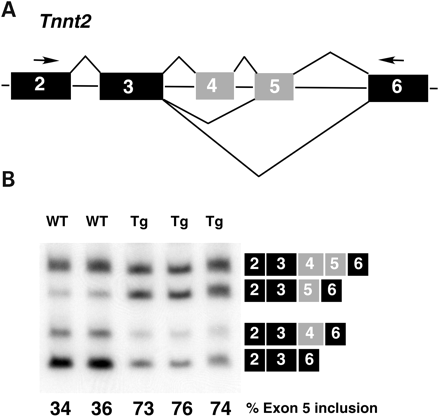 Figure 3. MCKCUG-BP1 mice display the inappropriate splicing pattern for Tnnt2 in heart. (A) Diagram of RT–PCR of cTNT. Forward and reverse PCR primers anneal to exons 2 and 6 (black), respectively. The resulting RT–PCR product that spans exons 2–6 detects the inclusion/exclusion of the alternative fetal exons 4 and 5 (gray). (B) RT–PCR analysis of Tnnt2 in mouse heart. Transgenic mice display increased inclusion of exon 5 when compared with wild-type littermates. Exon inclusion was assayed by RT–PCR. The percent exon inclusion was calculated as [(mRNA+exon 5)/(mRNA−exon 5+mRNA+exon 5)]×100. Each lane represents an individual mouse.