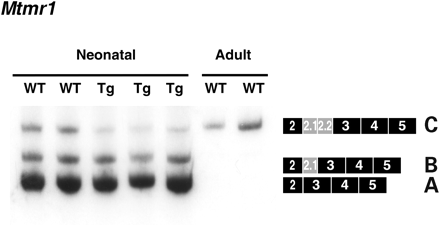 Figure 5. MCKCUG-BP1 mice display an altered Mtmr1 splicing pattern in skeletal muscle. RT–PCR analysis of Mtmr1 splicing in mouse skeletal muscle using primers that anneal to exons 2 and 5. Transgenic mice display increased expression of the fetal isoforms, A and B, when compared with wild-type littermates. As a control, adult wild-type mice were analyzed which express only the adult isoform, C. Each lane represents an individual mouse.