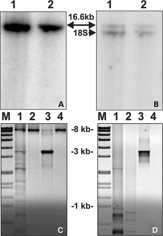 Figure 5. Southern blot analysis of mtDNA/18S rRNA gene and long-PCR of patient's muscle mtDNA. (A)Total muscle DNA was digested with restriction enzyme PvuII and hybridized with a cloned fragment of mtDNA (nt 1–740). Samples: 1, muscle DNA from a healthy control; 2, muscle DNA from the index patient and 16.6 kb indicates the full-size mtDNA. (B) Same membrane as in (A), stripped and reprobed with genomic 18S rRNA clone (lower band). Quantification of the hybridization signals indicated that mtDNA in index patient was 106% of that in control, normalized against the nuclear 18S signal. (C) Long-PCR of muscle mtDNA with 6 min or (D) 2 min extension times. M, molecular weight marker VII (Roche); 1, control patient with multiple mtDNA deletions (15); 2, index patient; 3, control patient with a single mtDNA deletion; 4, healthy control. Only deleted mtDNA is amplified in short 2 min extension conditions, whereas the wild-type mtDNA (8.2 kb) is also amplifying in long 6 min conditions.