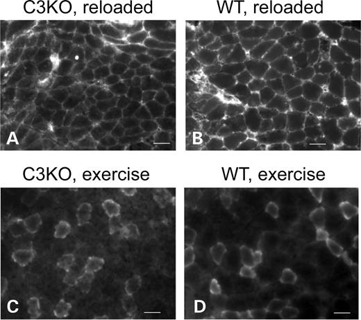 Figure 2. C3KO muscles are not more susceptible to muscle damaging conditions. Representative sections of C3KO (A) and WT (B) soleus muscles from mice subjected to 10 days of suspension followed by 2 days of reloading stained with FITC-conjugated anti-mouse IgG to visualize damaged fibers (19). (C and D) Representative sections of C3KO and WT gastrocnemius muscles after 4 days of treadmill running exercise and Evans blue injection to visualize damaged fibers. In both cases, staining is due to unspecific uptake of the labeled molecules by fibers with damaged membrane. Bars, 50 µm.