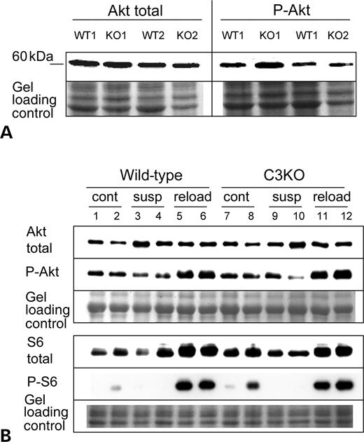 Figure 3. Activation of the IGF-1/PI3K/Akt pathway is not affected by the absence of CAPN3. (A) Western blots of extracts of C3KO and WT myotubes undergoing differentiation during 2.5 days in the presence of insulin–transferrin–selenium X were stained with antibodies that recognize all forms of Akt (total Akt) or Akt activated by phosphorylataion (P-Akt). No difference was found between C3KO and WT myotubes. (B) Representative western blot of muscle extracts from ambulatory control (cont), suspended for 10 days (susp) or reloaded for 2 days after suspension (reload) mice were stained with total Akt or activated Akt (P-Akt)-specific antibodies (upper panel) and with total ribosomal protein S6 and phospho-S6 antibodies (lower panel).