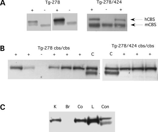 Figure 2. Immunoblot analysis of CBS. (A) Livers were harvested from Tg-278 and Tg-278/424 animals on zinc water and total protein extracts were examined for CBS levels using polyclonal anti-serum against human CBS. This serum detects both human and mouse CBS protein. The left panel shows two offspring from two different Tg-278 founder mice, while the right panel shows three offspring from the Tg-278/424 founder. The transgene status of the offspring is indicated at the top. The arrows indicate the human and the mouse CBS proteins. (B) CBS expression in Tg-278 and Tg-278/424 mice that lack mouse CBS (homozygous for the Cbs− allele) on zinc water. Lane C is a control extract from Tg-hCBS mouse on zinc water (16). (C) Tissue expression of transgene. A Tg-278/424 mouse lacking endogenous CBS on zinc water was sacrificed and extracts were prepared from the kidney (K), brain (Br), liver (L) and colon (Co).