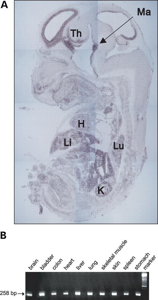 Figure 1. (A) Expression of Aspm in E14 whole mouse embryo detected by hybridization to the antisense probe. Embryonic parasagittal sections for in situ hybridization were prepared using a standard procedure. Th, thalamus; Ma, mammilary region; H, heart; Li, liver; Lu, lung; K, kidney. (B) Expression of human ASPM in embryonic tissues. The ASPM transcripts in various tissues were analyzed by RT–PCR. Expression analyses of mRNA were performed using human multiple fetal tissue cDNAs. The housekeeping gene, β-actin, was used as the internal control. β-Actin band of ∼838 bp was observed in all tissues (data not shown).