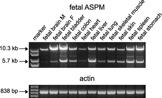 Figure 3. Alternatively spliced ASPM variants in fetal tissues. Two major ASPM transcripts with sizes of ∼10.3 and 5.7 kb were identified in all tissues analyzed. Additional spliced variants of variable sizes were also seen. β-Actin was used as the internal control.
