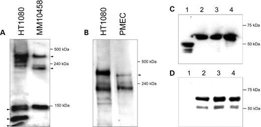 Figure 6. Antibodies to ASPM reveal several isoforms of the protein. (A) The protein extract (100 µg) from normal human cells (HT1080) and MM10458 cells carrying a frameshift mutation in ASPM was analyzed by SDS–PAGE, followed by immunoblotting using an anti-VTKR antibody. The sizes of the largest immunoreactive bands in HT1080 correspond to two predicted ASPM proteins (a full-size 410 kDa protein and a 218 kDa isoform lacking the exon 18-encoding segment). Because ASPM is truncated in MM10458 by a frameshift in exon 24, the predicted isoforms are 35 kDa shorter (i.e. 385 and 183 kDa, correspondingly). The anti-VTKR antibody also visualizes at least three additional bands in the HT1080 extract. Two of them are missing in the MM10458 extract. These bands may correspond to the predicted 164 and 124 kDa ASPM isoforms (Fig. 4). (B) Immunoblot analysis of mouse Aspm proteins using an anti-VTKR antibody. The largest immunoreactive band in the mouse cell extract seems to correspond to the predicted full-size 364 kDa Aspm protein that is 46 kDa shorter than the human ASPM. The second major band seems to correspond to the predicted 212 kDa mouse Aspm isoform, which lacks the exon 18-encoding segment and is approximately the same size as the human ASPM isoform (218 kDa). Note that the small size bands visible in Fig. 3A (i.e. <150 kDa) were run off the gel in order to see the difference between the full-size ASPM and Aspm proteins. (C and D) Western blot analysis showing the specificity of the affinity-purified anti-VTKR antibody. The antibody recognizes a recombinant MBP–ASPM fusion protein expressed in the pMAL-p2X expression vector. The protein extract (100 µg) from bacterial cells was analyzed by SDS–PAGE, followed by immunoblotting using either an anti-MBP antibody (C) or an anti-VTKR antibody (D). Lane 1 corresponds to the vector without the insert. The predicted ∼60 kDa band corresponding to the fusion protein was detected. Lanes 2, 3 and 4 correspond to individual transformants.