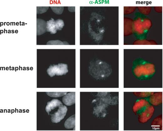Figure 7. Cytological analysis of ASPM proteins. Mitotic HT1080 cells grown on coverslips were analyzed by indirect immunofluorescent staining using antibodies against human ASPM (green) Chromosomal DNA was counterstained with DAPI (Red). Both anti-ASPM antibodies showed similar spindle pole-staining patterns during mitotic periods, prometaphase (VTRK), metaphase (QSPE) and anaphase (VTRK). The scale bar indicates 10 µm.