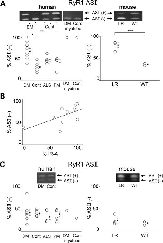 Figure 2. Analysis of RyR1 splice variants shows an increase in ASI(−) in DM1. (ALeft): RT–PCR analysis for exon ASI of RyR1 mRNA from skeletal muscle tissues of DM1 (DM, n=10), normal control (Cont, n=6), ALS (n=5) and PM (n=5) patients and myotubes cultured from DM and control patients. Top: Representative RT–PCR products. PCR products from ASI(+) (+exon70) and ASI(−) (−exon70) are 69 and 54 bp, respectively. Bottom: The mean percentages of the human RyR1 ASI(−) isoform: *P=0.003, **P=0.04. (ARight): RT–PCR analysis at ASI from skeletal muscle tissues of adult HSALR mice (LR, n=4) and adult WT mice (n=3). Top: Representative RT–PCR products. Bottom: The mean percentages of mouse RyR1 ASI(−) isoform: ***P=0.03. (B) Relationship between the proportion of RyR1 ASI(−) and that of the IR-A insulin receptor in skeletal muscle tissues from DM1 patients. The percentage of RyR1 ASI(−) (Y-axis) plotted against that of IR-A (X-axis). R=0.694, P=0.0374. (C) RT–PCR analysis for RyR1 exon ASII mRNA from skeletal muscle tissues of patients (left) and mice (right). Top: Representative RT–PCR products. Bottom: The mean percentages of RyR1 ASII(−) isoform.