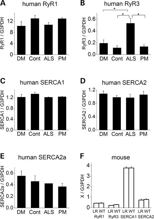 Figure 5. Analysis of the amount of mRNA using semi-quantitive RT–PCR shows no change in RyR1, RyR3, SERCAs in human DM1 or the mouse DM model. (A–E): Relative amounts of RyR1 (A), RyR3 (B), SERCA1 (C), total SERCA2 (D) and SERCA2a (E) mRNA levels in skeletal muscles from DM1 (DM), normal control (Cont), ALS and PM patients. (F) Relative amounts of RyR1, RyR3, SERCA1 and SERCA2 from HSALR (LR) and WT mice muscle. *P<0.05.