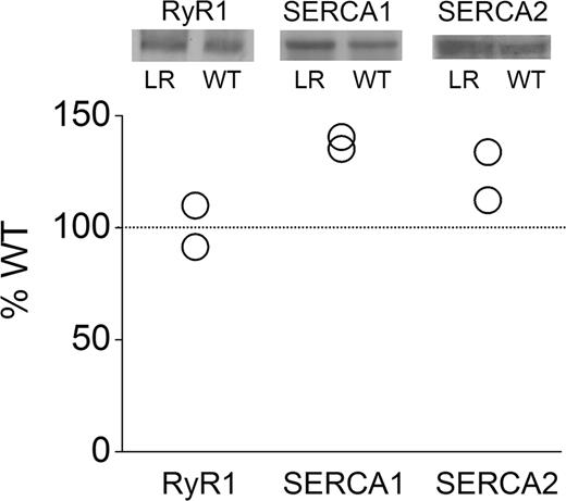 Figure 6. Immunoblot analysis shows no change in RyR1 protein expression in the mouse DM model, but an increase in SERCA1 and 2 expression. Top: Immunoblot analyses of RyR1, SERCA1 and SERCA2 in skeletal muscle from WT and HSALR mice. Bottom: The densities of immunoblot assay from HSALR normalized with that from WT are shown.