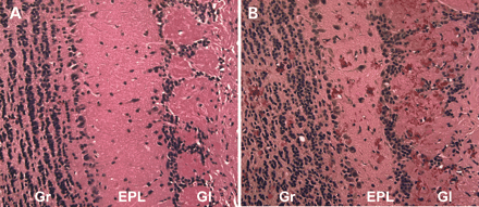 Figure 1. Rosenthal fibers in the olfactory bulb of GFAP transgenic mice. Hematoxylin and eosin stain of olfactory bulbs in Tg73.7 GFAP transgenic female mice at 3 months of age. Rosenthal fibers in the form of eosinophilic aggregates are present throughout the bulb and particularly in the glomerular layer (B). Wild-type age- and sex-matched mice show no aggregate formation as demonstrated in (A). Gr, granular cell layer and white matter tracts; EPL, external plexiform layer; Gl, glomerular layer (200× magnification).