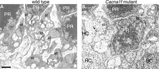 Figure 6. Electron micrographs of the wild-type (A) and Cacna1f-mutant (B) retinas. The arrow in the right panel indicates a residual synaptic ribbon. PR, photoreceptor nucleus; HC, horizontal cell; st, synaptic terminal. Scale bar: 1 µm.
