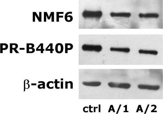 Figure 1. Representative immunoblots of platelet NMMHC-IIA. The figure reports a representative example of immunoblots obtained from platelet lysates of patients from family A. This family carries the R1933X mutation resulting in the deletion of a 27-residues COOH-terminal fragment of NMMHC-IIA. Twenty microgram of total platelet lysates were separated on a 5–15% gradient poliacrylamide gel, transferred to nitrocellulose and probed with an Ab recognizing an epitope of the head of NMMHC-IIA (NMF6), an Ab that specifically recognizes the last 12 COOH-terminal amino acids of NMMHC-IIA (PR-B440P) and with an anti-β-actin (AC-15), as indicated on the left. When compared with platelets from a healthy donor (ctrl), both patients from family A express a similar amount of β-actin, but a strongly reduced amount of NMMHC-IIA, as revealed by immunoblotting with NMF6 Ab. The figure also shows that the residual NMMHC-IIA expressed in platelets from patients A/1 and A/2 is the wild-type protein, as it reacts with the PR-B440P Ab whose epitope is deleted in the mutated protein. 