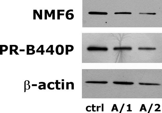 Figure 2. Representative immunoblots of megakaryocyte NMMHC-IIA. Megakaryocytes were cultured from PB progenitors of family A and purified by immunomagnetic beads technique on the basis of CD41 expression. Upon cell lysis, 50 µg of proteins were separated on polyacrylamide gel, transferred to nitrocellulose and probed with Abs NMF6 and PR-B440P anti-NMMHC-IIA and AC-15 anti-β-actin. While all the samples reported in the figure express similar amount of β-actin, analysis with the NMF6 Ab, which binds to both wild-type and mutant protein, or with Ab PR-B440P, which binds exclusively to the wild-type protein, revealed a reduced expression of NMMHC-IIA in Mks from both patients A/1 and A/2. 