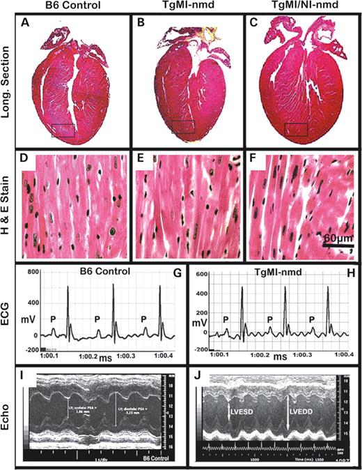 Figure 3. Gross morphology, histology, electrocardiographic and echocardiographic presentations of B6-control versus TgMI transgenic rescued nmd hearts at 8–16 weeks of age. ( A–C ) H&E-stained longitudinal sections show normal morphologic appearance of the heart. Magnification of the rectangular areas near the cardiac apex shows cardiomyocytes staining uniformly in B6-control heart ( D ) similar to transgenic ( E ) and double transgenic ( F ) hearts, indicating a lack of pathological changes. These observations are consistent with a normal ECG pattern in B6-control ( G ) analogous with the transgenic rescue ( H ), both indicative of healthy cardiac conduction. Normal echocardiograms, manifested by relatively robust LVEDD and LVESD in B6-control ( I ) heart similar to the transgenic ( J ) heart, further attest to the cardiac rescue. 