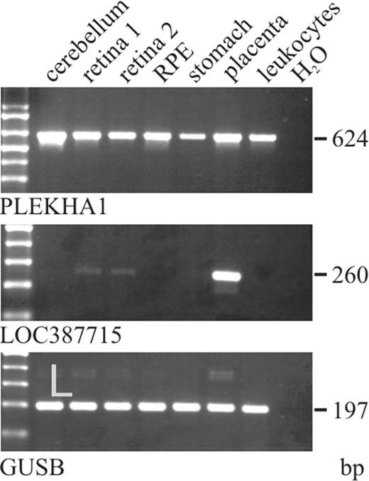 Figure 3. RT–PCR expression analysis of the PLEKHA1 and LOC387715 genes. In each case, forward and reverse primers were exon-spanning to avoid amplification products resulting from minor genomic contamination of the mRNA preparations. Expression of the housekeeping gene GUSB is shown as a control to test for first-strand cDNA integrity. 