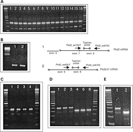 Figure 3. RT–PCR amplifications of Pkd2/PKD2 exon 7 and PKD2 exon 9 formats. DNA size standard is the 100 bp DNA ladder (Invitrogen). ( A ) Pkd2 exon7/Pkd2Δ7 amplification from total RNA of murine tissues. Lane 1, skeletal muscle; lane 2, intestines; lane 3, spleen; lane 4, kidney; lane 5, skin; lane 6, lung; lane 7, testes; lane 8, pancreas; lane 9, eye; lane 10, adrenal gland; lane 11, heart; lane 12, brain; lane 13, stomach; lane 14, thymus; lane 15, liver; lane 16, embryo, ∼16.5 pc. ( B) Specific amplification of Pkd2, exon 7 and the Pkd2Δ7 variant from total RNA (mouse embryo). Lane 1, 174 bp PCR product characteristic of exon 7; lane 2, 169 bp PCR product indicative of Pkd2Δ7. A real-time PCR approach scheme based on specific amplification of Pkd2 exon 7 and lack of exon 7 diagnostic prdoducts. ( C ) PKD2 exon7/Pkd2Δ7 amplification from total RNA of human cell lines. Lane 1, T98G; lane 2, HMEC-1; lane 3, HUVEC; lane 4, A549. ( D ) PKD2 exon7/Pkd2Δ7 (lanes 1–3) and Pkd2 exon 9/Pkd2Δ9 (lanes 4–6) amplifications from polysomal fraction mRNA of HMEC-1 cells. Amplicon bands indicative of Pkd2 exon 7 (390 bp) and Pkd2Δ7 (222 bp) can be seen in lanes 1–3. In contrast, only a PCR product of 301 bp characteristic for exon 9 and no Pkd2Δ9 diagnostic band of 180 bp is to be seen in lanes 4–6. ( E ) PKD2 exon7/Pkd2Δ7 (lane 1) and Pkd2 exon 9/Pkd2Δ9 (lane 2) amplifications from total RNA of HMEC-1 cells. 
