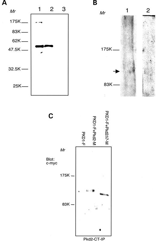 Figure 5. Characterization of the anti-Pkd2-Ct antibodies. ( A ) Bacterial expression of (GST)–Pkd2-Ct fsuion protein, predicted relative molecular mass 57.9 kDa. Western blot detection with Pkd2-Ct antibodies, 12% polyacrylamide gel (PAAG). Lane 1, glutathione sepharose 4B beads, loaded with (GST)–Pkd2-Ct; lane 2, culture lysate of (GST)–Pkd2-Ct expressing Escheirichia coli XL-1; lane 3, culture lysate of GST-expressing E. coli XL-1 (negative control). ( B ) Western blot analysis with Pkd2-Ct antibodies, 6% PAAG. Lane 1, mouse kidney lysate; lane 2, HMEC-1 cells lysate. Arrow points at polycystin-2 band. ( C ) Immunoprecipitation of polycystin-2 and polycystin-2Δ7. Cell lysates are obtained from HeLa cells transfected with PKD1-F (lane 1); PKD1-F+Pkd2-M (lane 2) and PKD1+Pkd2Δ7−M (lane 3). Products immunoprecipitated (IP) with anti-Pkd2-Ct antibodies and detected with anti c-myc antibodies. 