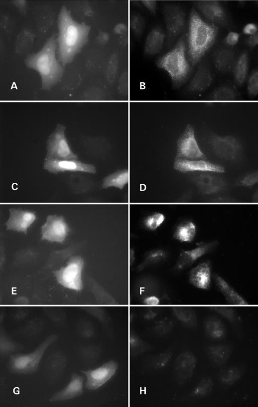 Figure 7. Subcellular localization of polycystin-2 and polycystin-2Δ7 in HeLa cells by immunofluorescence. ( A, B, G and H ) Pkd2-transfected cells; ( C – F ) Pkd2Δ7-transfected cells; (A, C, E and G) EGFP marks transfected cells (bi-cistronic expression of Pkd2/Pkd2Δ7 and EGFP); (B, D, F, andH) Pkd2 C-term antibodies staining; (A–D) permeabilized cells; (E–H) non-permeabilzed cells. 