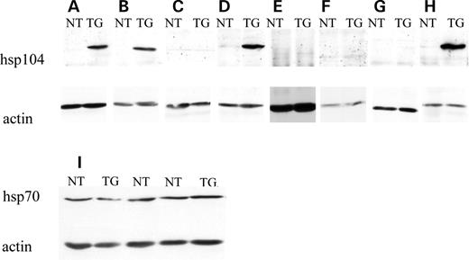 Figure 1. Detection of the hsp104 protein by western blot analysis. (A–H) Whole brain homogenates from a 14-week-old transgenic mouse (TG) and non-transgenic littermate (NT) were probed with anti-hsp104 antibody. The pattern of expression is typical of the MoPrP promoter: the hsp104 protein (upper panels) is specifically expressed in the brain (A), kidney (B), testis (D) and heart (H) of the transgenic mouse but not in the muscle (C), spleen (E), liver (F) or lung (G). (I) The expression of hsp104 in the whole brain of otherwise normal mouse does not modify the levels of endogenous hsp70. Lanes 2 and 5, Hsp104 mice (Tg); lanes 1, 3 and 4, non-transgenic littermates (NT). Actin (lower bands) was used as a loading control.