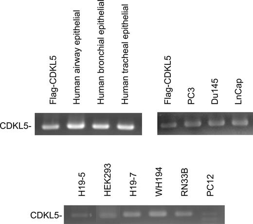 Figure 1. Cellular expression of the CDKL5 mRNA transcript. Total RNA was isolated from human lung cells (HBE, HAE, HTE), human androgen-dependent and androgen-independent prostate tumor cells (PC3, Du145, LnCAP), human embryonic kidney cells (293) and rat neural cell lines [H19-7 (hippocampal), H19-5 (glial), RN33B (Raphe), PC12 (pheochromocytoma)]. RT–PCR was performed on the RNA samples using primers derived from CDKL5 cDNA. A FLAG-CDKL5 cDNA template was used as a positive control. This result is representative of three independent experiments. 
