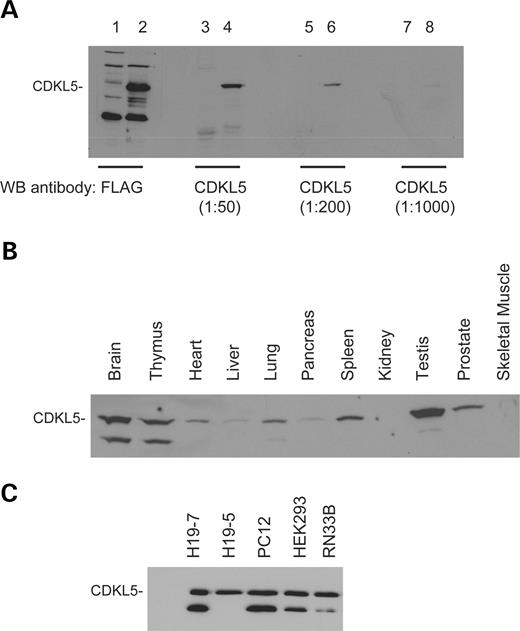 Figure 2. The CDKL5 protein is expressed in a variety of tissues and cell lines. ( A ) Specificity of the polyclonal anti-CDKL5 antibody. COS cells were transfected with either FLAG-CDKL5 (Lanes 2, 4, 6 and 8) or empty pc-DNA vector (Lanes 1, 3, 5 and 7). Lysates were prepared and resolved by SDS–PAGE. Western blotting analysis of the samples was performed with the anti-FLAG monoclonal antibody (Lanes 1 and 2) or the anti-CDKL5 polyclonal antibody (Lanes 3–8) at the indicated concentrations. ( B) Expression of CDKL5 in tissues. Extracts from adult male rat tissues were resolved by SDS–PAGE. The samples were analyzed by western blotting using the anti-CDKL5 polyclonal antibody. ( C) Expression of CDKL5 in cell lines. Lysates were prepared from H19-7, H19-5, PC12, HEK293 and RN33B cell lines and resolved by SDS–PAGE. The samples were analyzed by immunoblotting with the anti-CDKL5 polyclonal antibody. This result is representative of three independent experiments. 