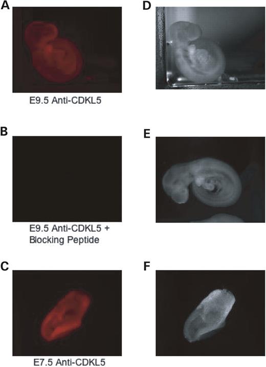 Figure 3. CDKL5 is ubiquitously expressed in mouse embryos. ( A) Immunofluorescence of endogenous CDKL5 at embryonic stage day 9.5. E9.5 embryos were fixed and visualized by immunocytochemistry with the polyclonal anti-CDKL5 antibody. ( B ) Immunostaining is specific. E9.5 embryos were fixed and visualized by immunocytochemistry with polyclonal anti-CDKL5 antibody and a blocking peptide corresponding to the anti-CDKL5 antibody epitope. ( C ) Immunofluorescence of endogenous CDKL5 at embryonic stage day 7.5. E7.5 embryos were fixed and visualized by immunocytochemistry with polyclonal anti-CDKL5 antibody. ( D–F) Light phase microscopy depicting the whole mouse embryo in samples A–C. This result is representative of two independent experiments. 