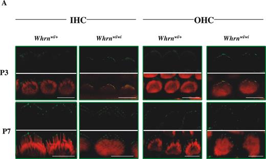 Figure 5. Analysis of myosin XVa and whirlin localization in the whirlin and shaker2 mutants. (A) Comparison of localization of myosin XVa (green) between wild-type (C3H/HeN) mice and whirlin-deficient mouse (Whrnwi/wi) in stereocilia of IHCs and OHCs of the organ of Corti (apical turns of cochlea) at P3 and P7. Rhodamine–phalloidin staining in the red channel highlights the actin core of stereocilia. Merged images highlight myosin XVa protein localization in actin-free (green) and actin-rich (yellow) areas. (B) Localization of whirlin (green signals) in myosin XVa-deficient mouse (Myo15ash2/sh2) stereocilia of IHCs and OHCs of the organ of Corti (apical turns of cochlea) at P6, P8 and P11. Scale bars=5 µm.