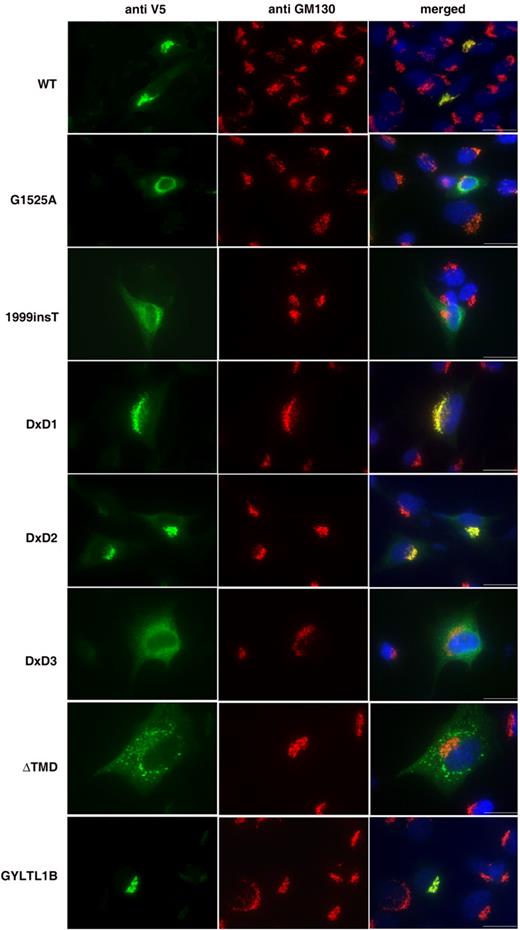 Figure 2. Localization of LARGE–V5 and GYLTL1B–V5 constructs in transfected C2C12 myoblast cultures. Cultures were double-labelled with anti-V5 (green channel) and the Golgi marker GM130 (red channel). Co-localization can be seen in the merged pictures of LARGE wild-type (WT), LARGE DxD1→NNN, LARGE DxD2→NNN and GYLTL1B constructs. No co-localization was seen with LARGE constructs harbouring MDC1D mutations (G1525A and 1999insT), LARGE DxD3→NNN or LARGE ΔTMD. Blue channel, Hoechst 33342 nuclear stain; Scale bar, 20 µm. 
