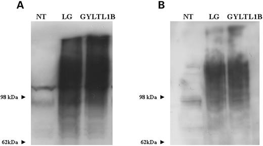 Figure 6. ( A ) Western blot analysis of protein lysates from CHO cultures transfected with LARGE and GYLTL1B using α-dystroglycan IIH6 antibody. Both constructs can be seen to be equally effective in stimulating α-dystroglycan hyperglycosylation. ( B ) Laminin-1 overlay assay of the same western blot showing LARGE and GLYLT1B-induced α-dystroglycan hyperglycosylation binds laminin. NT, non treated; LG, LARGE V5. 